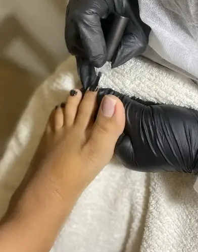 Resultado de pedicura smart